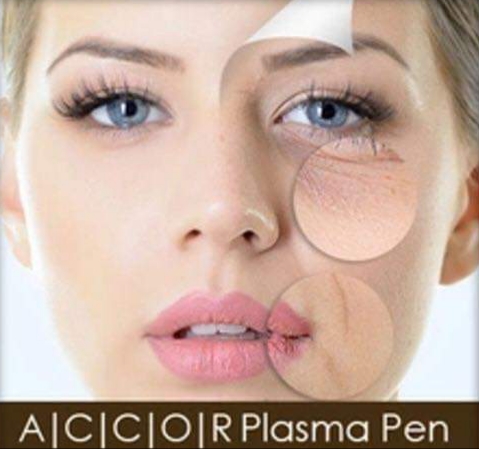 Plasma Pen Wien